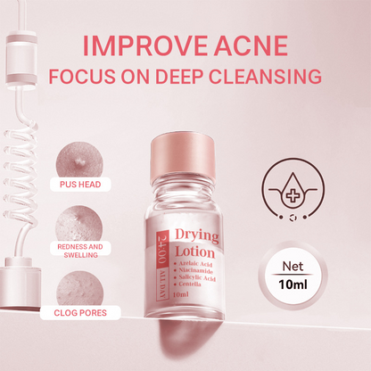 🔥🏆BUY 2 GET 1 FREE!🎁Salicylic Acid Spot Drying Lotion